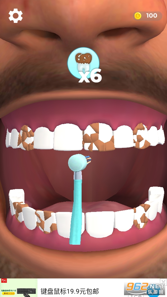 假牙医生游戏图3