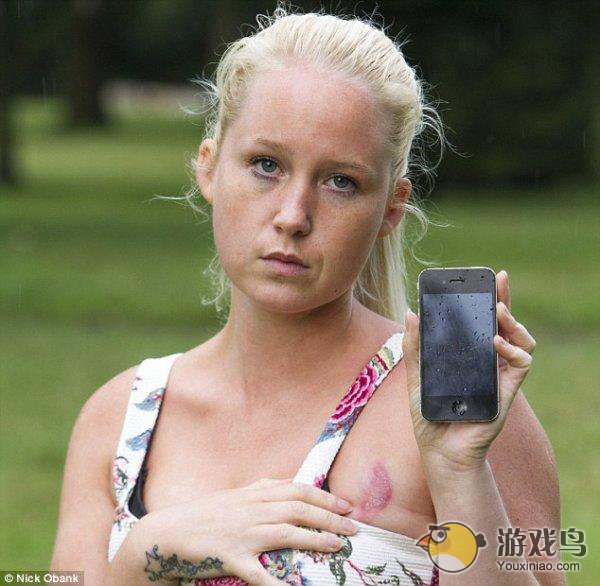 iPhone再曝灼伤事故 英国一女子乳房被灼伤[图]图片1