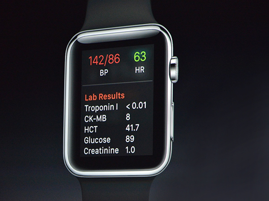 Apple Watch第二代的规格以及功能等曝光[多图]图片1